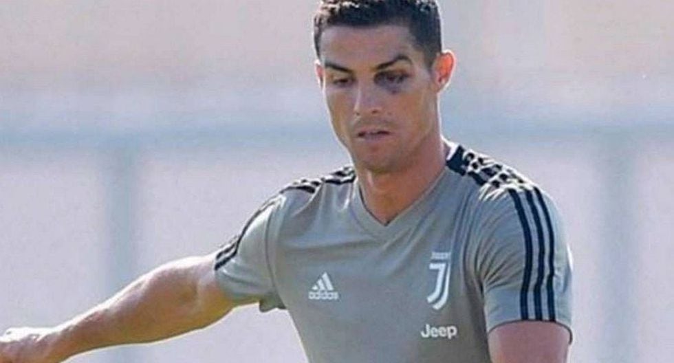 Cristiano Ronaldo apareció en las prácticas de Juventus con un ojo morado