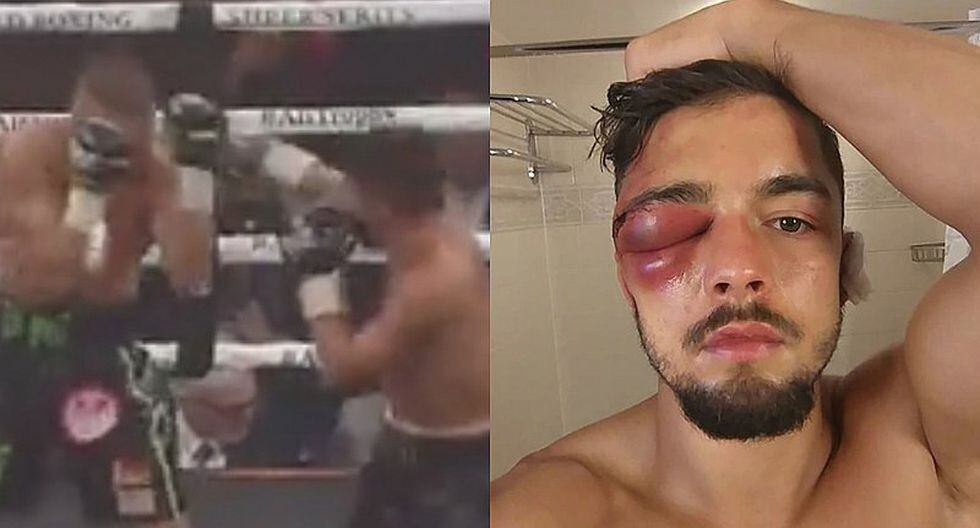 La increíble lesión en el ojo de un boxeador por un título del mundo