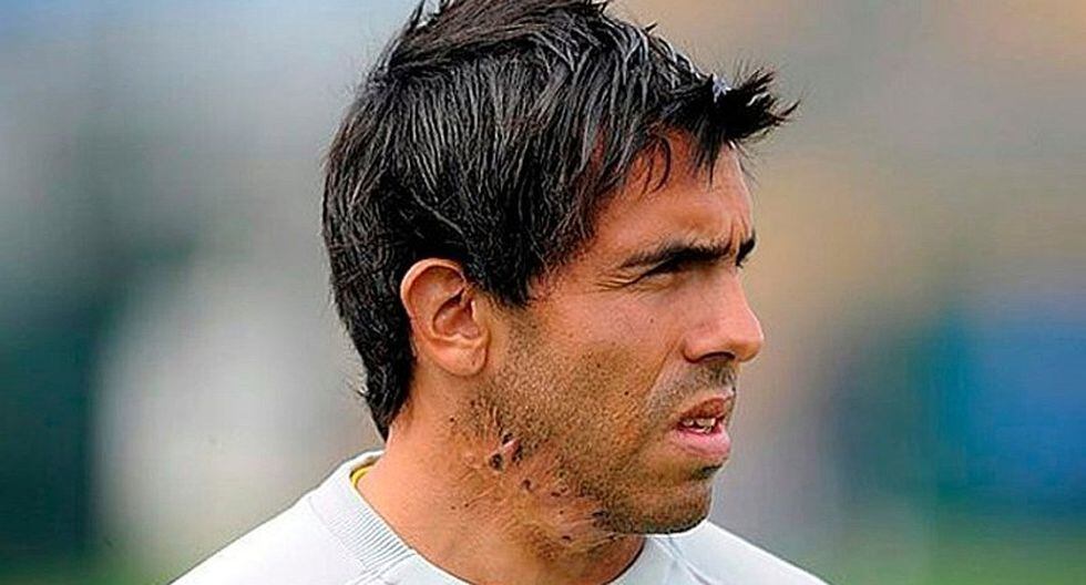 VER Netflix | Más información del por qué Carlos Tevez tiene cicatrices en el cuello | FOTOS y VIDEO